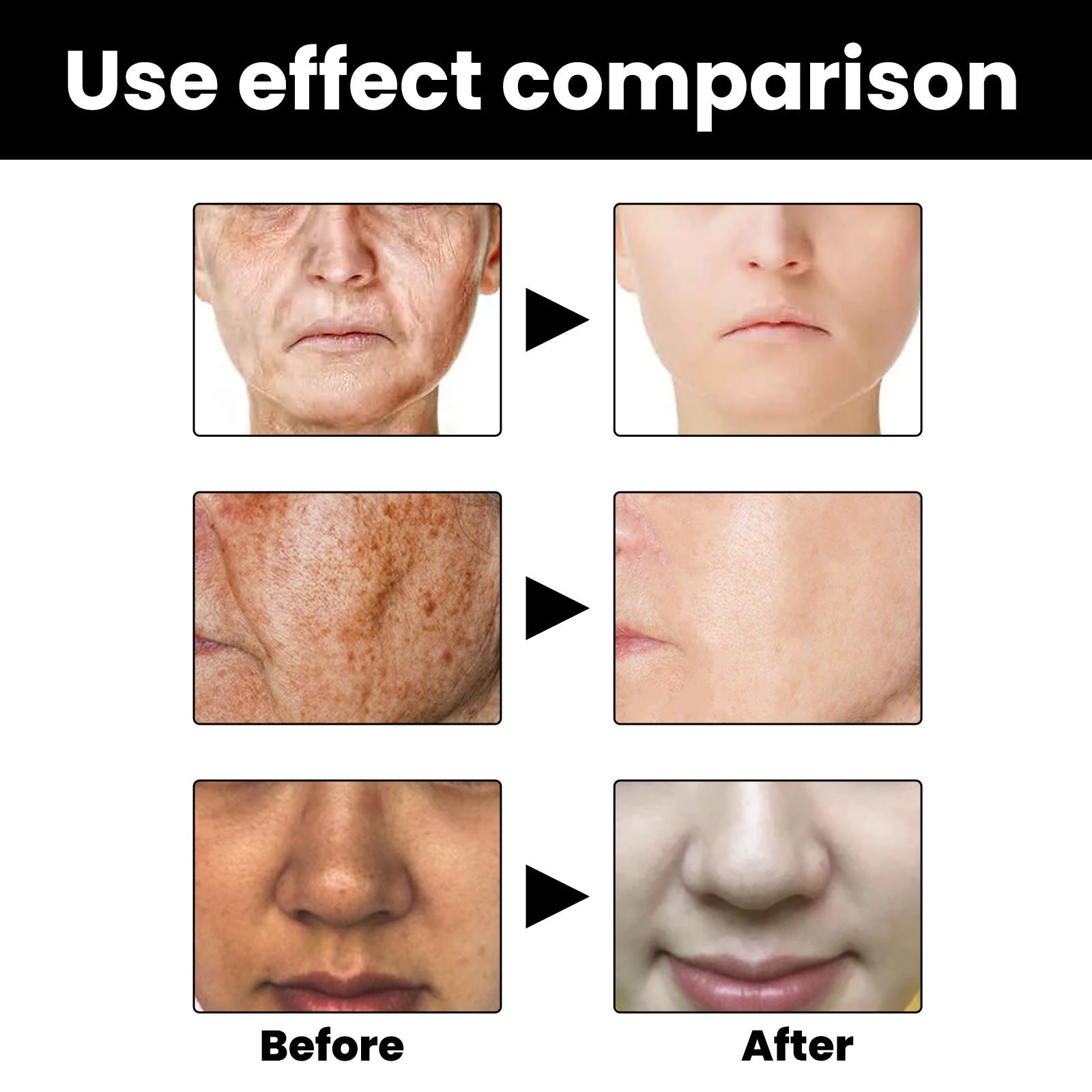 Before and after effect comparison of skin treatment on a person's face.