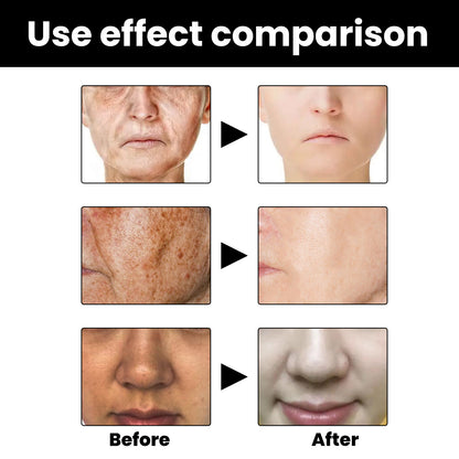 Before and after effect comparison of skin treatment on a person's face.