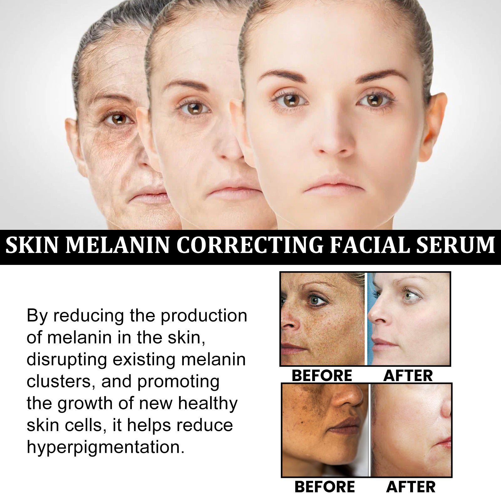 Advertisement for a skin melanin correcting facial serum with before and after images of skin.
